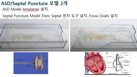 ASD Closure & Transseptal Model